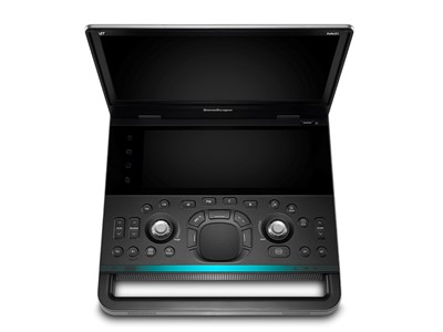 Portable Ultrasound point of care